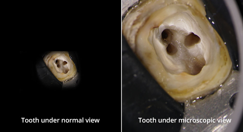 Best Endodontics in  Dubai