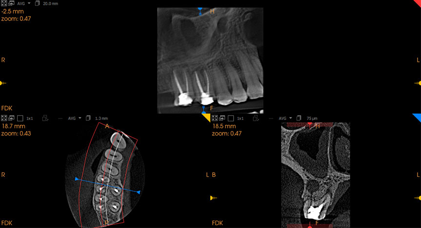 cone beam CT machine dubai