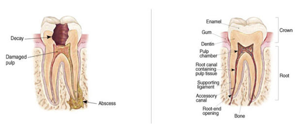 Conventional Endodontics in Dubai