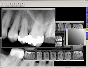 digital dental radiography dubai