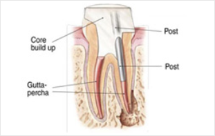 Endodontist dubai